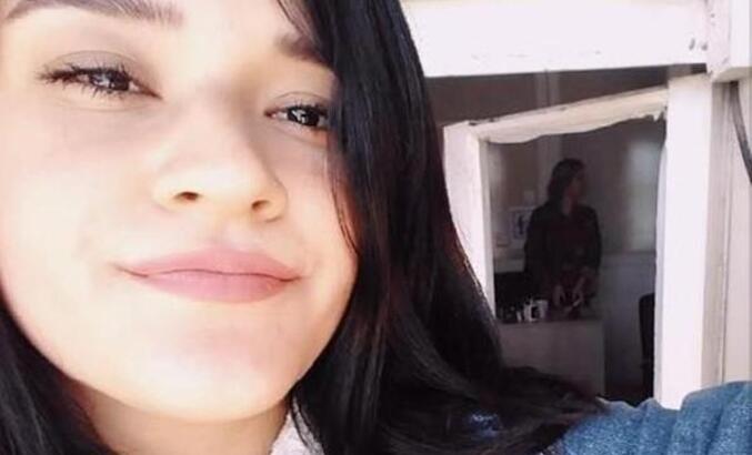 Yüzü Yanan Berfin İnstagram Hesabı