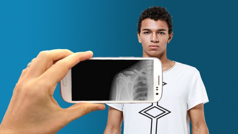 X-Ray Mobile v2.0 APK İndir (2022)