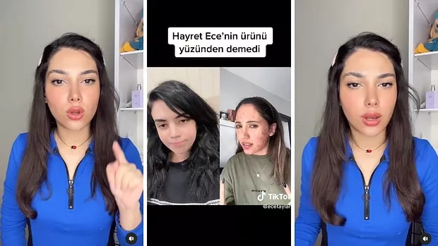 Ece Ronay Sivilce Kremi Olayı (Yağmur Eroğlu) Gerçek mi?