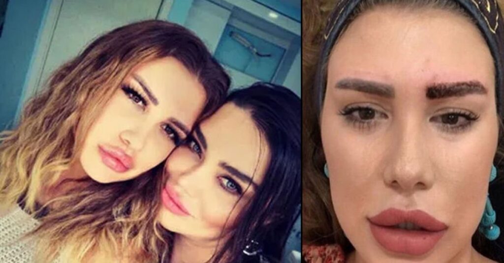 Melis Buse Betkayan Reşit Bozdağ Olayı (Tüm Merak Edilenler) 